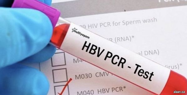 دبي تلغي شرط عمل فحص pcR للقادمين إليها وتكتفي باختبارهم فور الوصول