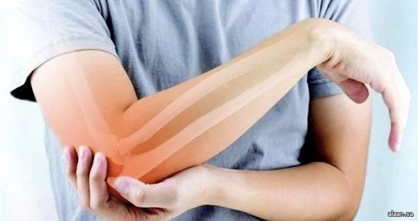 دواء جديد لترميم العظام بعد الإصابات ..