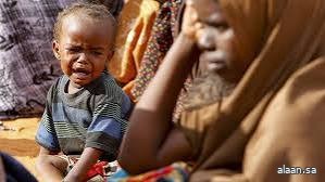 الأمم المتحدة: ملايين الأطفال في السودان يعانون من سوء التغذية