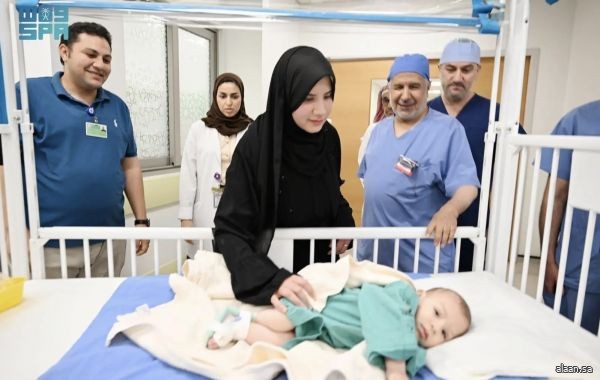 إنفاذًا لتوجيهات خادم الحرمين الشريفين وسمو ولي العهد.. بدء عملية فصل التوأم الطفيلي المصري محمد عبدالرحمن جمعة
