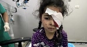 صحة غزه : 1500 فلسطيني فقدوا البصر بسبب الحرب