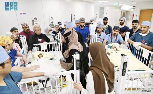 فصل التوأم الملتصق الإريتري "أسماء وسمية" بنجاح بعد عملية جراحية دقيقة استغرقت 15 ساعة ونصفًا