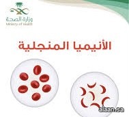 المملكة تنهض بدورها ضمن دول العالم في الوقاية من مرض الأنيميا المنجلية بتكثيف البرامج والأنشطة والمعارض وورش العمل المملكة تنهض بدورها ضمن دول العالم في الوقاية من مرض الأنيميا المنجلية بتكثيف البرامج والأنشطة والمعارض وورش العمل