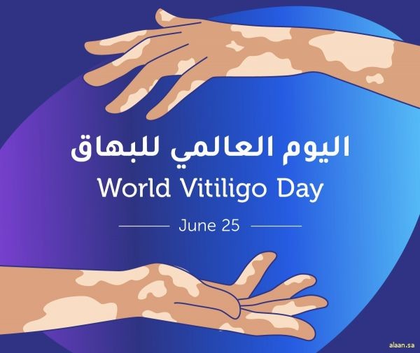 السعودية نموذجٌ فاعلٌ في العمل الإنساني والصحي لدعم مرضى البهاق وتحقيق الاندماج المجتمعي السعودية نموذجٌ فاعلٌ في العمل الإنساني والصحي لدعم مرضى البهاق وتحقيق الاندماج المجتمعي
