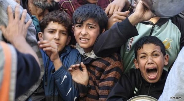 الأمم المتحدة تدعو إلى تحرّك عاجل بعد وفاة أكثر من 100 طفل جراء سوء التغذية في غزة