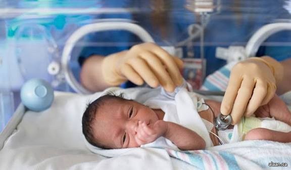 الهواء المُلوَّث يُبطئ نمو دماغ حديثي الولادة الهواء المُلوَّث يُبطئ نمو دماغ حديثي الولادة