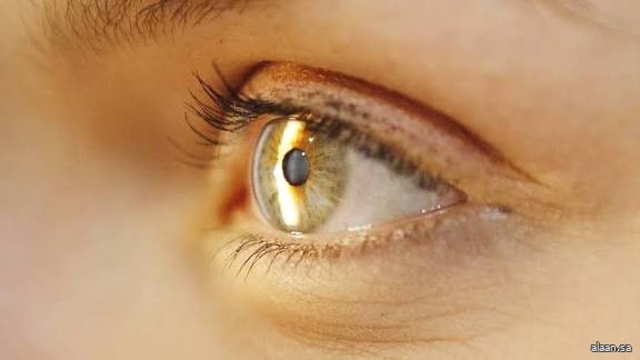 زراعة قرنية منتجة بالطباعة ثلاثية الأبعاد في إنسان