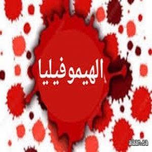 "هيموفيليا" .. مرض وراثي يُسبب خللاً في الجسم