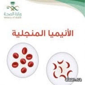 المملكة تنهض بدورها ضمن دول العالم في الوقاية من مرض الأنيميا المنجلية بتكثيف البرامج والأنشطة والمعارض وورش العمل